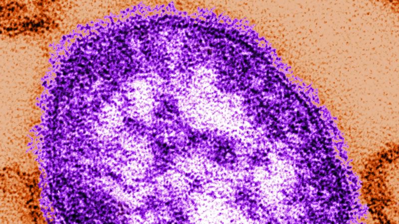The Americas Becomes First Region of World to Eliminate Measles