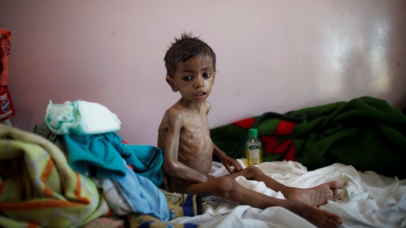 UN Agency: Child Malnutrition at ‘All-time High’ in Yemen