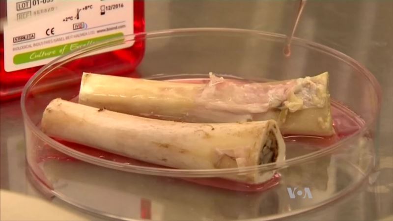 Lab-grown Bones Successfully Transplanted