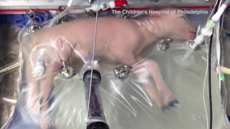 Artificial Womb Provides Hope for Premature Babies