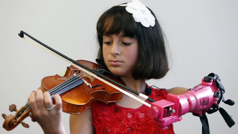 US Undergrads Build Prosthetic Arm for 10-year-old Violinist