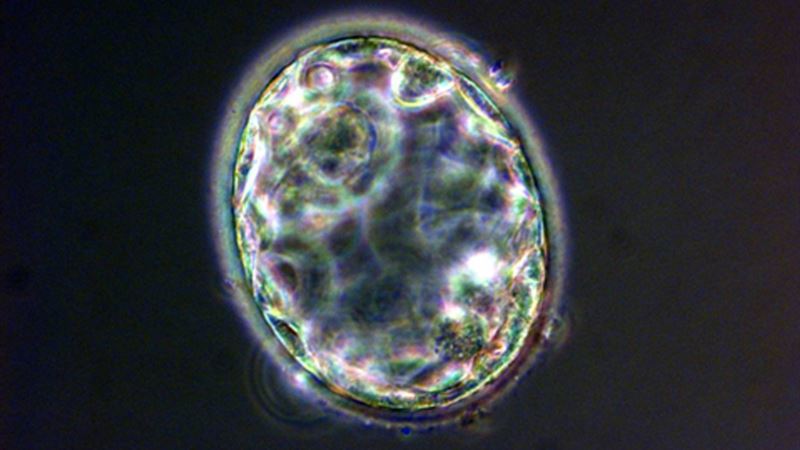 Scientists Remove Gene in Human Embryos to See What It Does