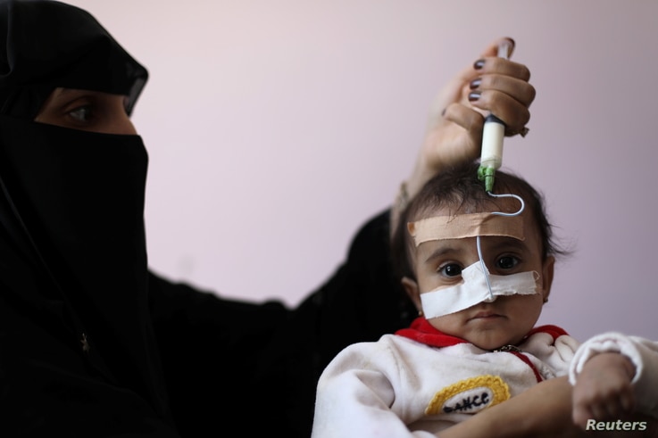 A woman uses a syringe to feed her malnourished daughter at a malnutrition treatment ward of al-Sabeen hospital in Sanaa, Yemen…