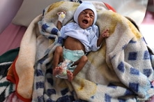 A malnourished child cries at the malnutrition treatment ward of al-Sabeen hospital in Sanaa, Yemen October 27, 2020. REUTERS…